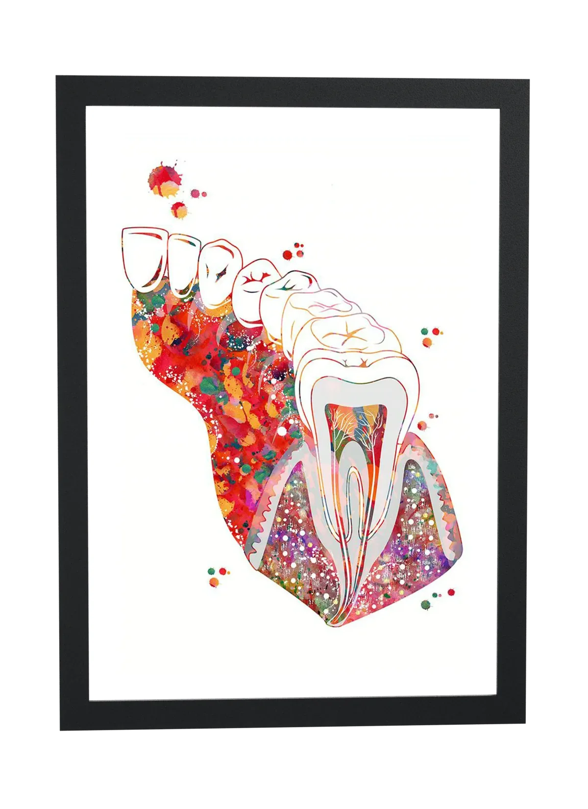 Pôster Anatomia do dente em aquarela emoldurado